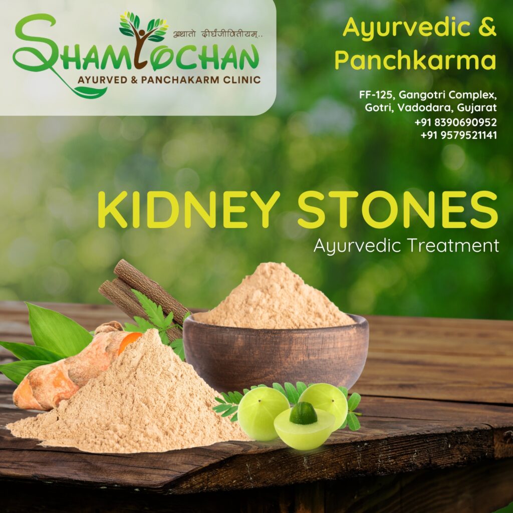 Your Comprehensive Guide to the Best Ayurvedic Kidney Stone Treatment in 2024